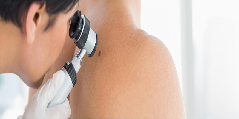 dermatology