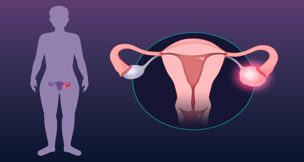 gynaecology